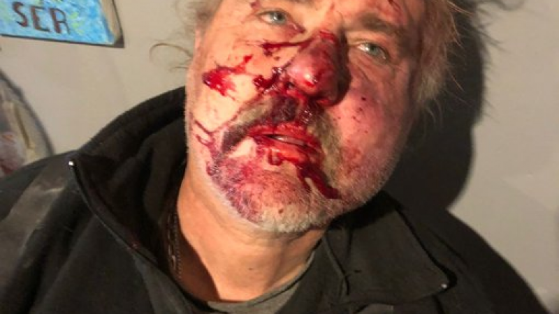 El brutal testimonio y video de un mecánico masacrado por un cliente: "Cerró la puerta para que..."